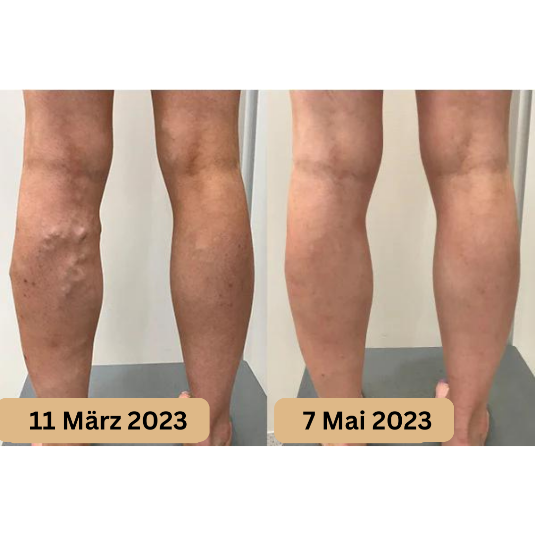 Fußmassagematte – AcupressureFlow