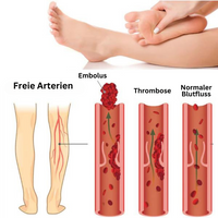 Fußmassagematte – AcupressureFlow