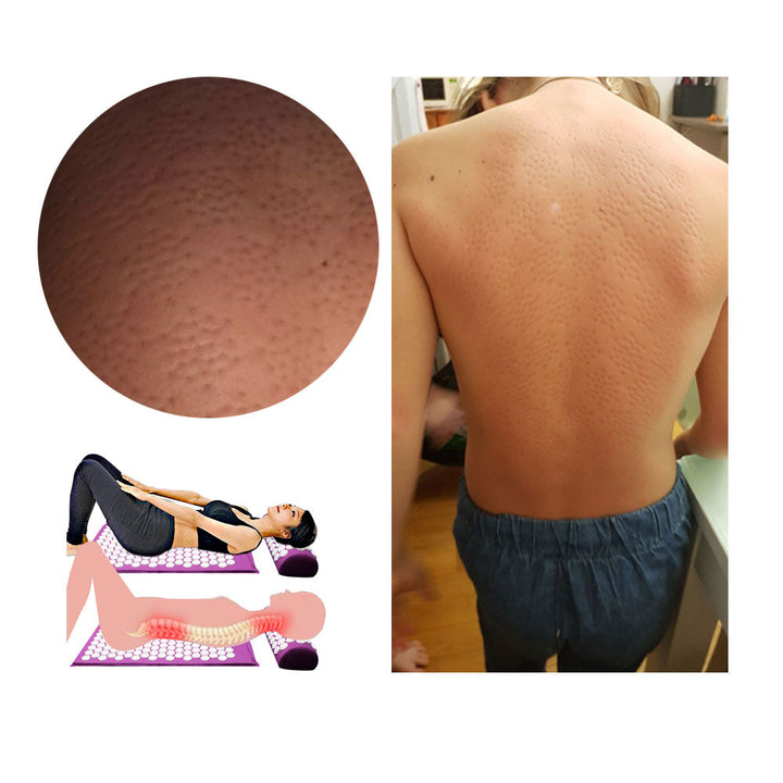 Akupressur-Yogamatte & Kissen-Set – RelaxMat