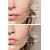 7-in-1 LED Gesichtsstraffungs- & Massagetool – Vénera