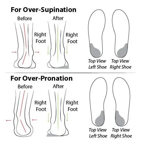 Bequeme Orthopädische Sommerschuhe mit Dämpfung – Tessa