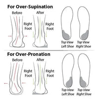 Bequeme Orthopädische Sommerschuhe mit Dämpfung – Tessa