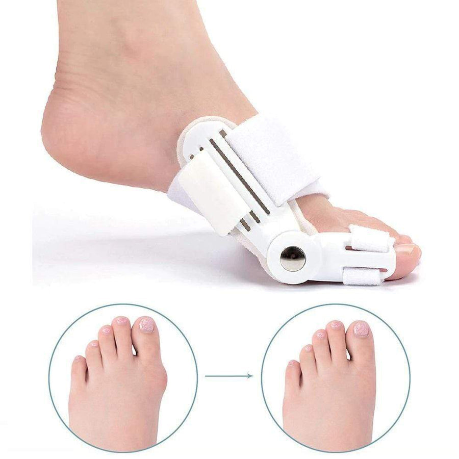 Korrigierende Schiene für Hallux Valgus (1 Paar) - BunionFix